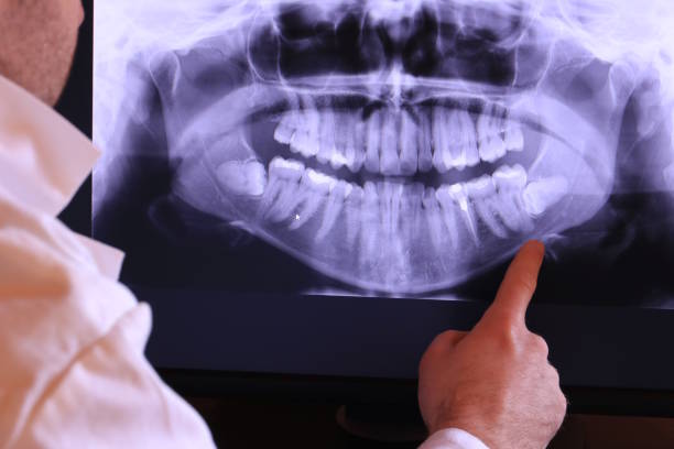 Best Pediatric Emergency Dentist in Wenatchee, WA